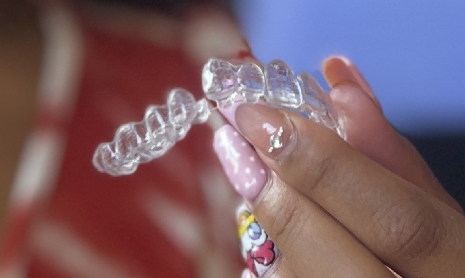 Ortodoncia invisible como solución a la maloclusión dental