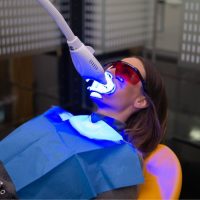 BLANQUEAMIENTO DENTAL EN CLINICA METODICA