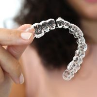 ORTODONCIA INVISIBLE RAPIDA GENIOVA