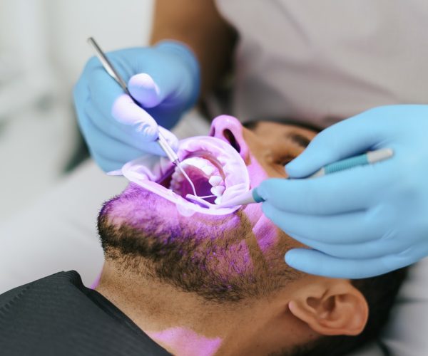 Male dentist hands examine patient
